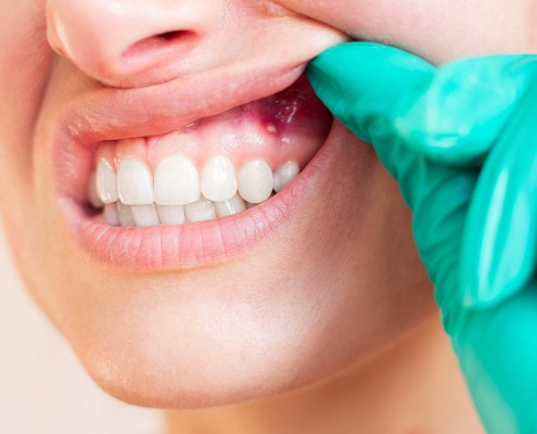 Septische Chirurgie im Mund & Kieferbereich